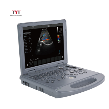 Clear Imaging 3D/4D Portable Color Doppler Echocardiography Ultrasound scanner machine price for Pregnancy